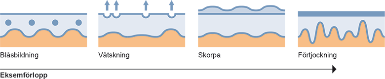 Eksemförlopp